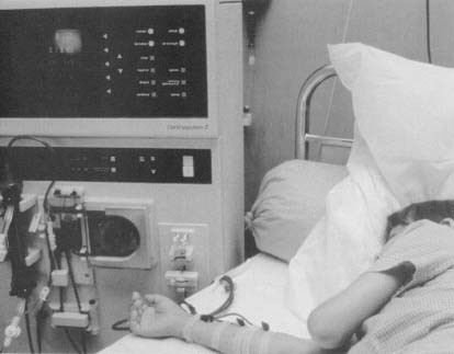 A young patient receives dialysis treatment.